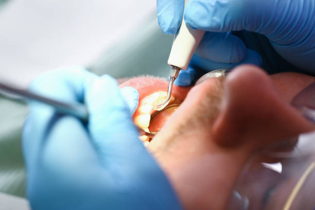 Best Urgent Care for Lost Fillings or Crowns in Orange Grove, TX
